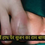Swelling in hath pair